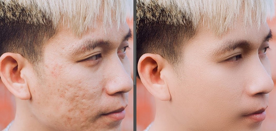 【软件/PS插件】快速人像磨皮润肤美容修饰PS插件 SkinFiner 4.0 Mac中文版插图(3)